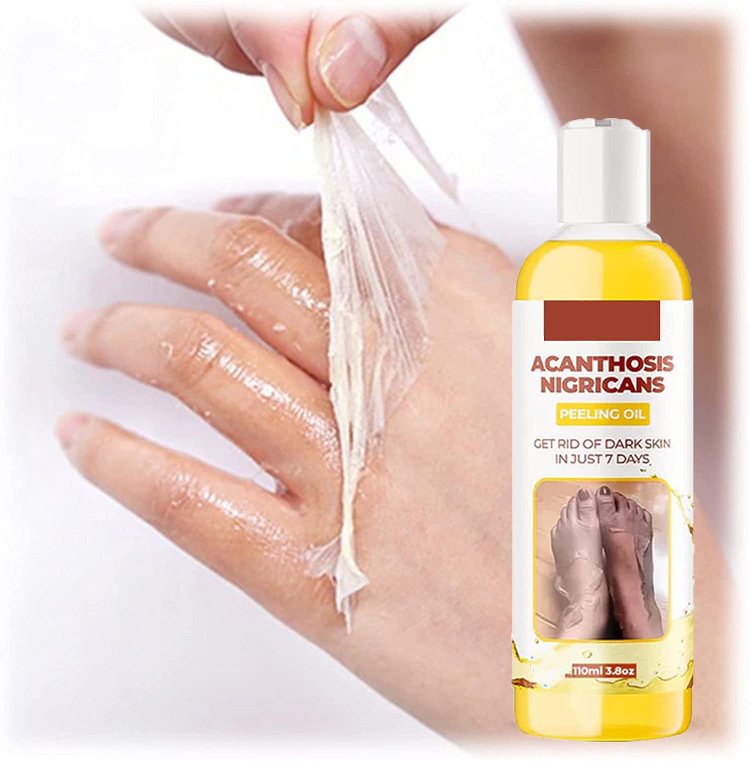 GFOUK Acanthosis Nigricans Treatment Oil - Dark Spot Corrector & Skin Whitening Peeling Oil for Neck, Armpits & Body - Natural Therapy for Hyperpigmentation & Skin Renewal (1 Bottle) - Perfect for Daily Skincare Routine & Post-Shaving Care