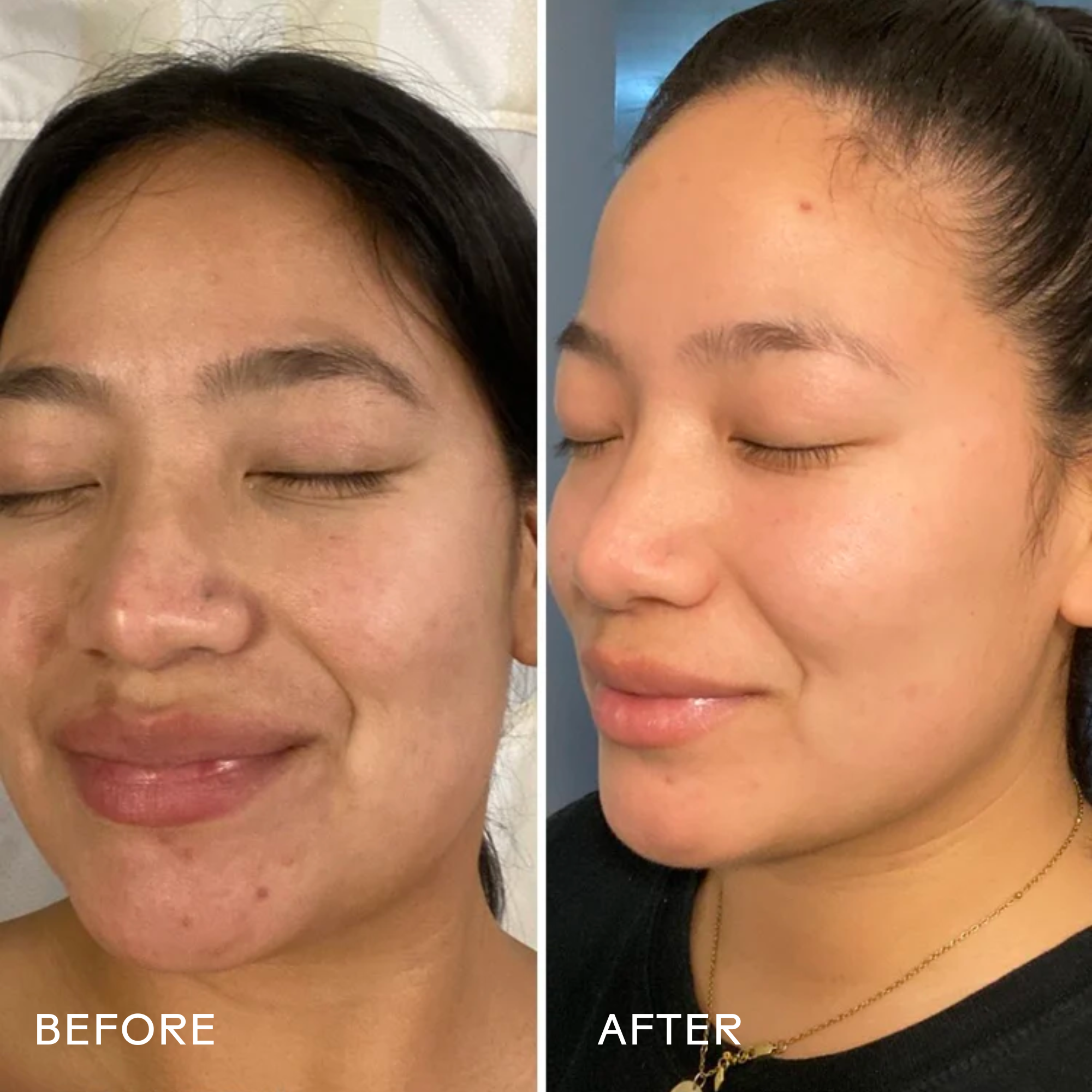 Dream Bio Retinol + Shorea Butter Anti-Aging Face Cream for Wrinkles & Fine Lines - Hydrating Night Moisturizer for Glowing Skin | Perfect for Daily Skincare Routine & Nighttime Rejuvenation