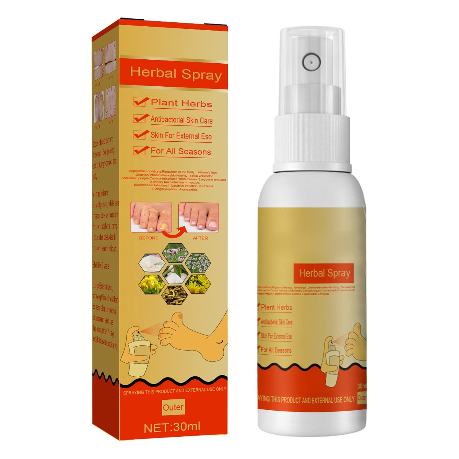 Best Athlete's Foot Treatment Spray - Antifungal & Deodorizing Foot Care for Dermatophytosis & Ringworm Relief - Odor Control & Freshening Solution for Active Lifestyles & Gym Enthusiasts
