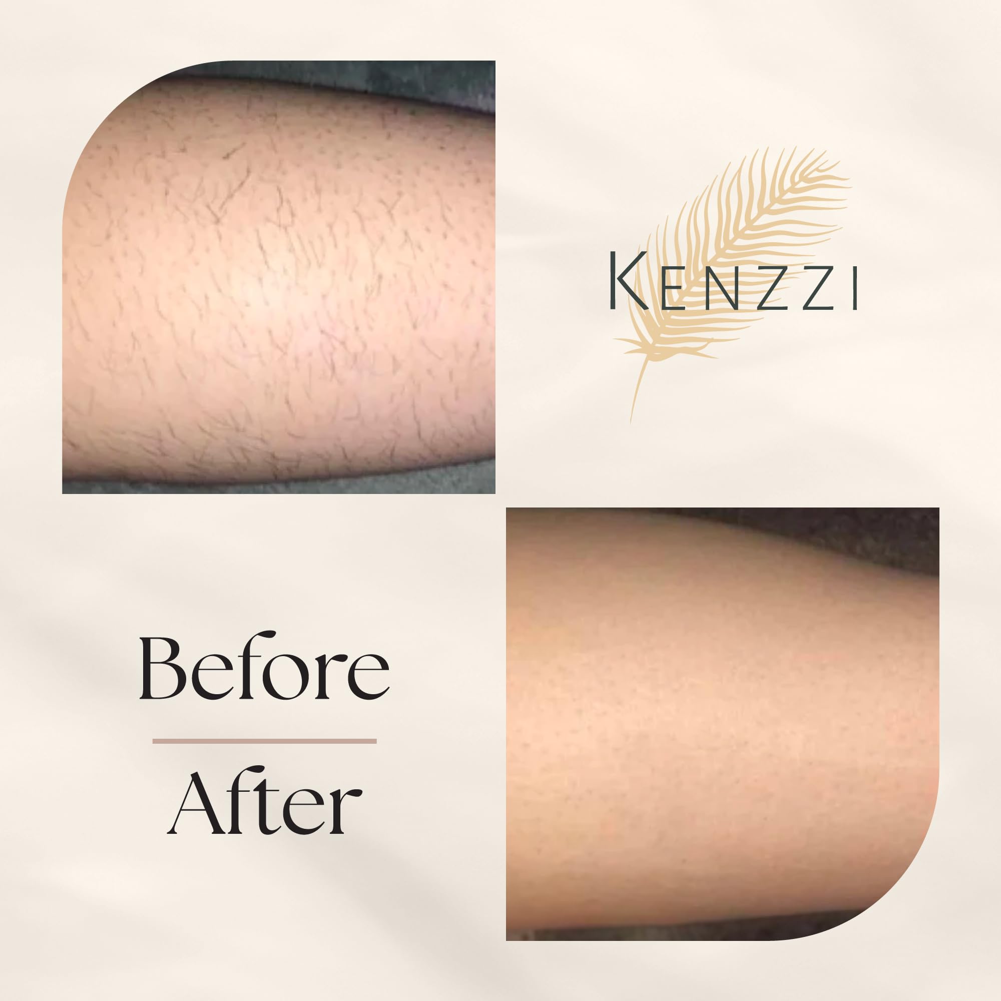 Kenzzi IPL Hair Removal Device for Women & Men - Painless At-Home Laser Hair Removal Handset for Face & Body, Permanent Hair Reduction Alternative to Salon Treatments | Smooth Skin for Bikini, Legs, Underarms & More