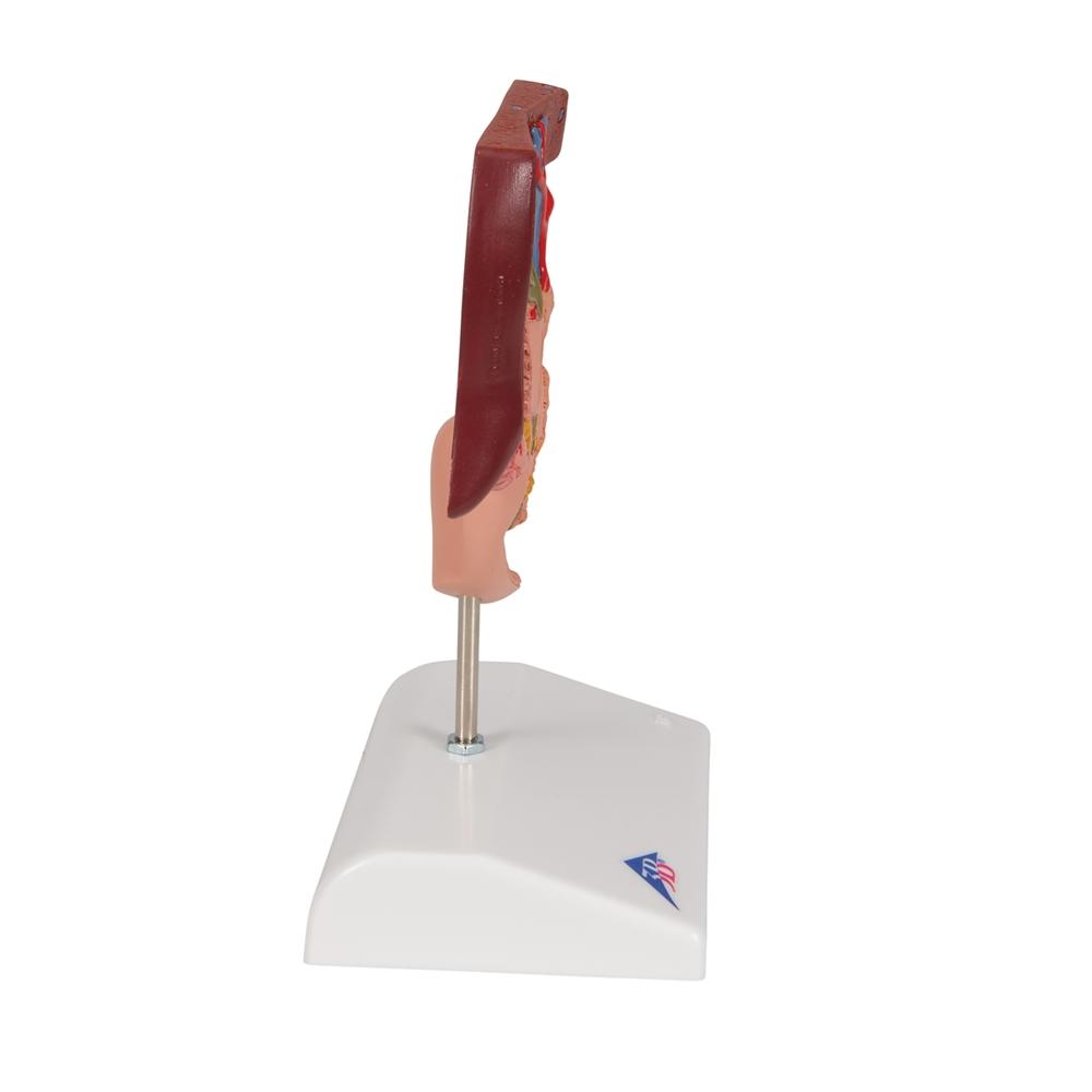 Gallstone Model with 3B Smart Anatomy K26 - Medical Teaching Tool for Human Digestive System Study & Classroom Demonstration