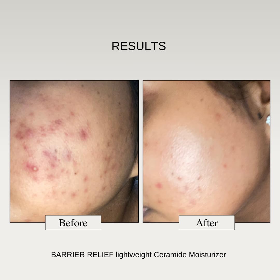 The Formularx Barrier Relief Ceramide Lightweight Moisturizer with Niacinamide & Hyaluronic Acid | For Oily, Combination, Dehydrated, Acne-Prone & Sensitive Skin | 50g | Daily Hydration & Skin Barrier Repair for Face & Body | Perfect for AM/PM Skincare Routine