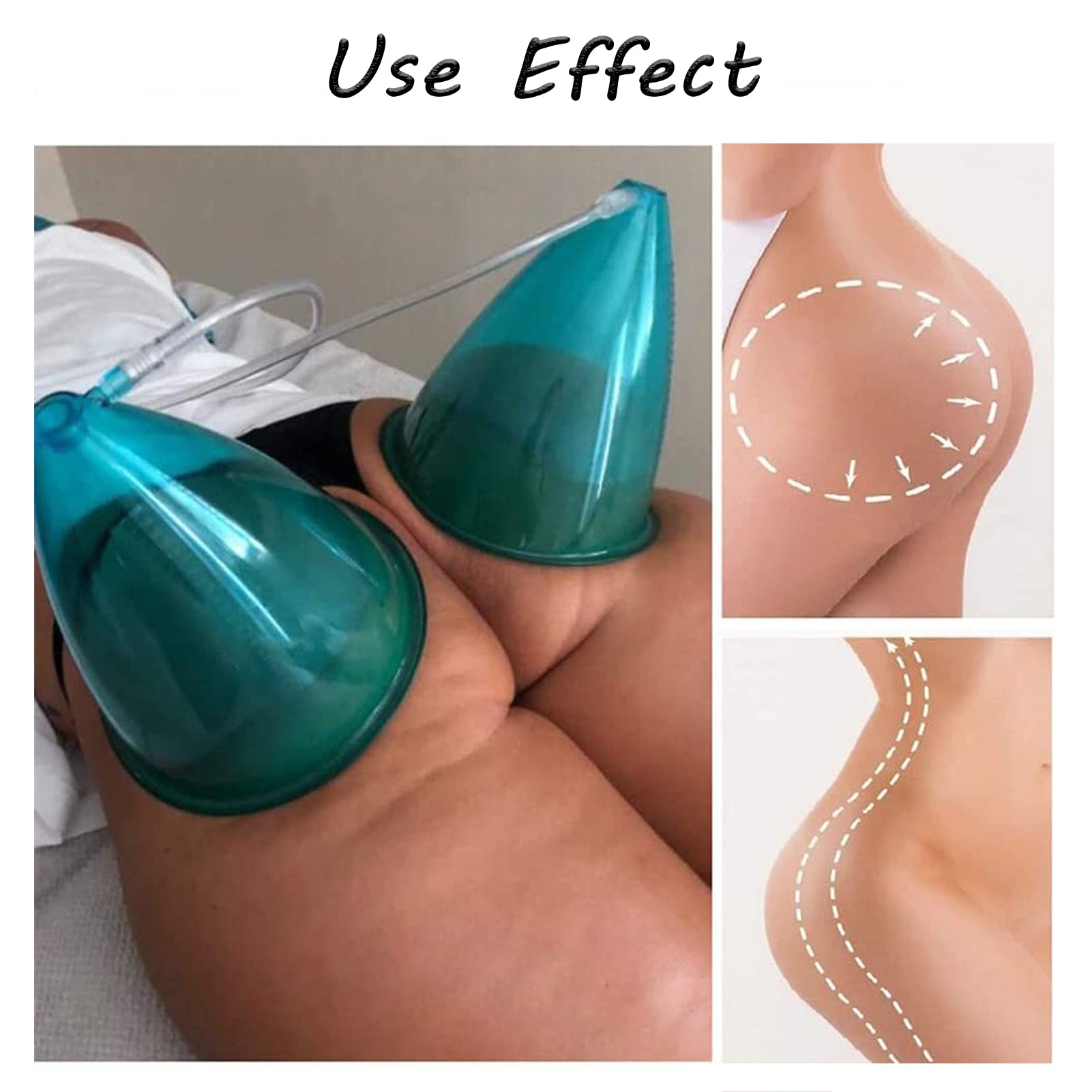 180ML Vacuum Massage Cupping Therapy Set - Large Suction Cups for Body Sculpting, Butt Lifting & Pain Relief with Y-Hose | Professional Home Spa Equipment for Cellulite Reduction & Muscle Relaxation | Perfect for Post-Workout Recovery & Beauty Treatments