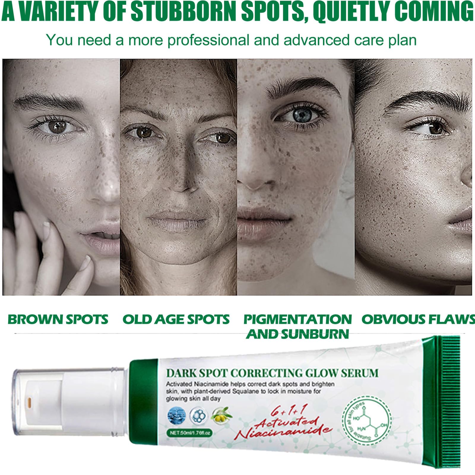 KOAHDE Anti Stain Face Serum & Dark Spot Correcting Cream - Skin Brightening, Lightening & Moisturizing Treatment for Hyperpigmentation & Uneven Tone | Day & Night Use for Glowing Complexion