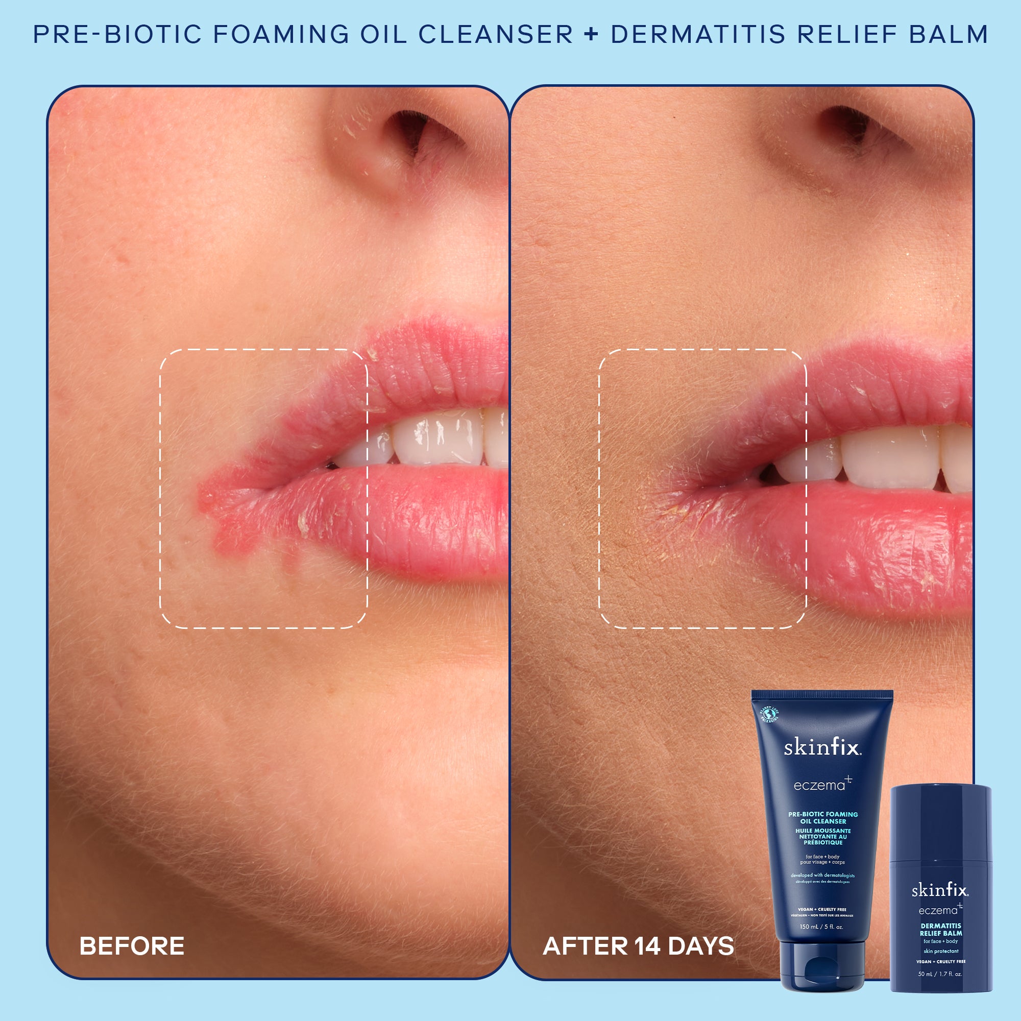 Dr. Lio's Eczema Relief Skin Rescue Trio - Soothing Cream, Balm & Wash for Dry, Itchy Skin - Perfect for Daily Eczema Care & Sensitive Skin Relief