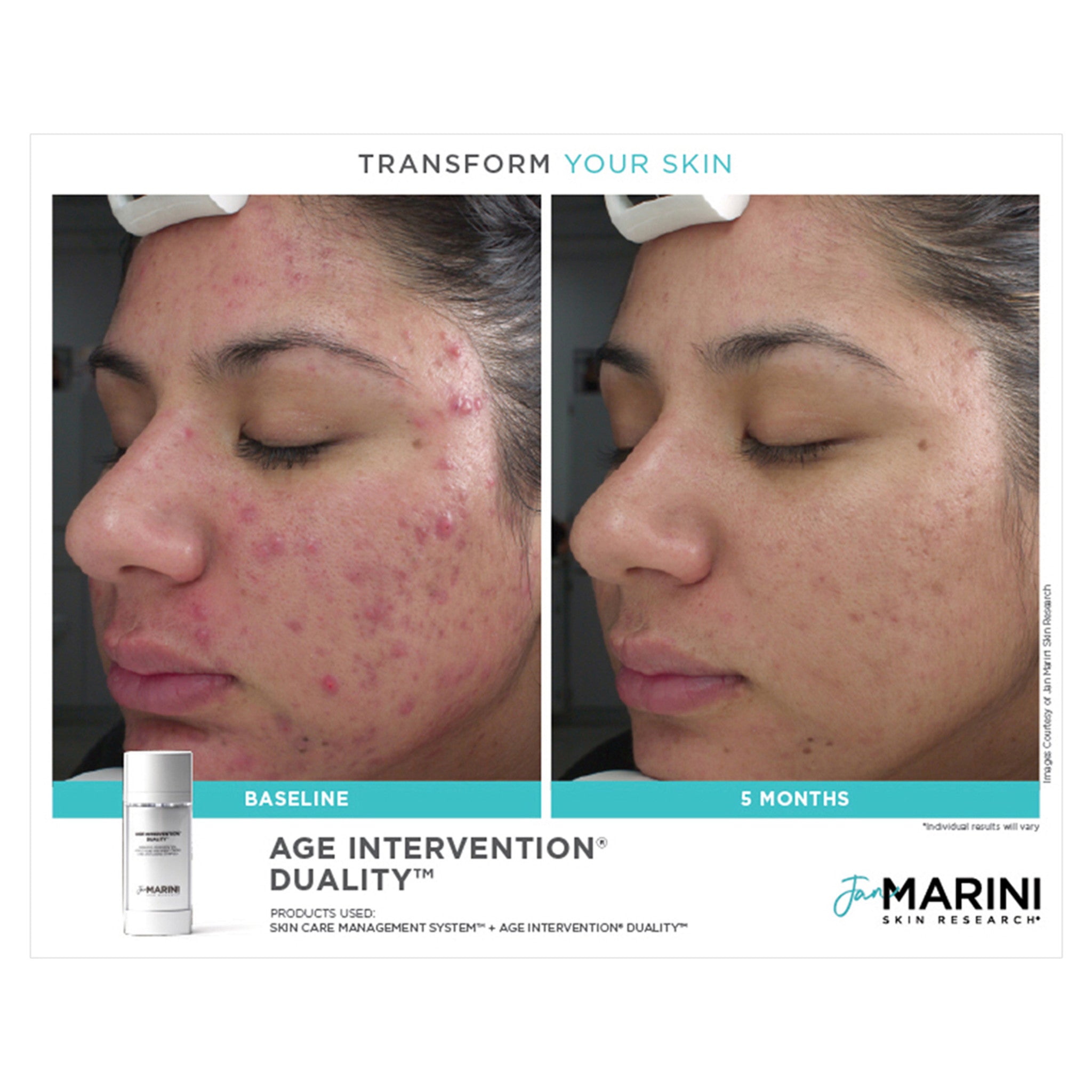 Age Intervention Duality Anti-Aging Cream - Reduce Wrinkles & Fine Lines - For Mature Skin Care Routine - Perfect for Nighttime Use & Daily Moisturizing