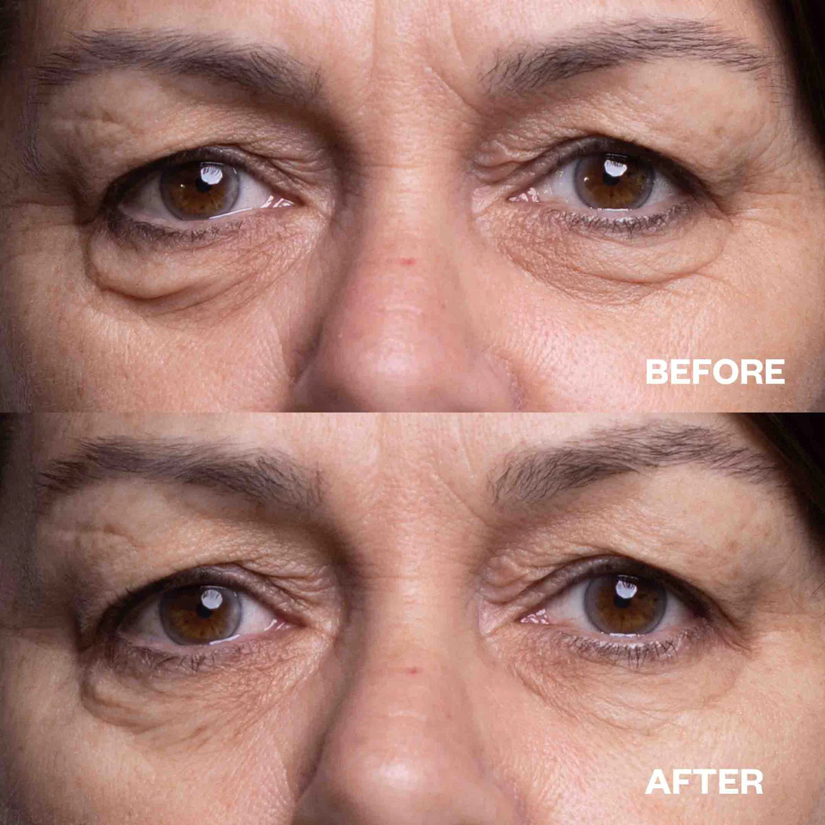 Anti-Aging Eye Wrinkle Patches - Under Eye Gel Pads for Dark Circles & Puffiness - Hydrating Collagen Treatment for Smooth Skin - Perfect for Night Care & Travel Skincare Routine