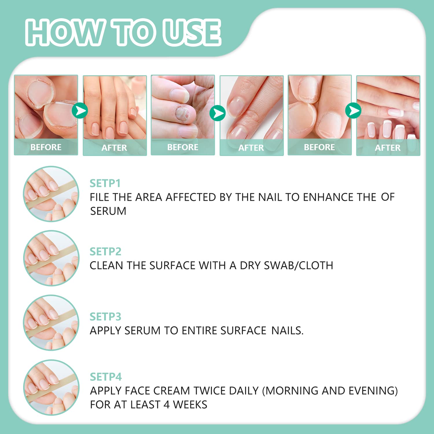 3Pack Kerassentials Nail Liquid & Oil Set - Fungus Treatment for Toenails & Fingernails - Perfect for At-Home Nail Care & Salon Use