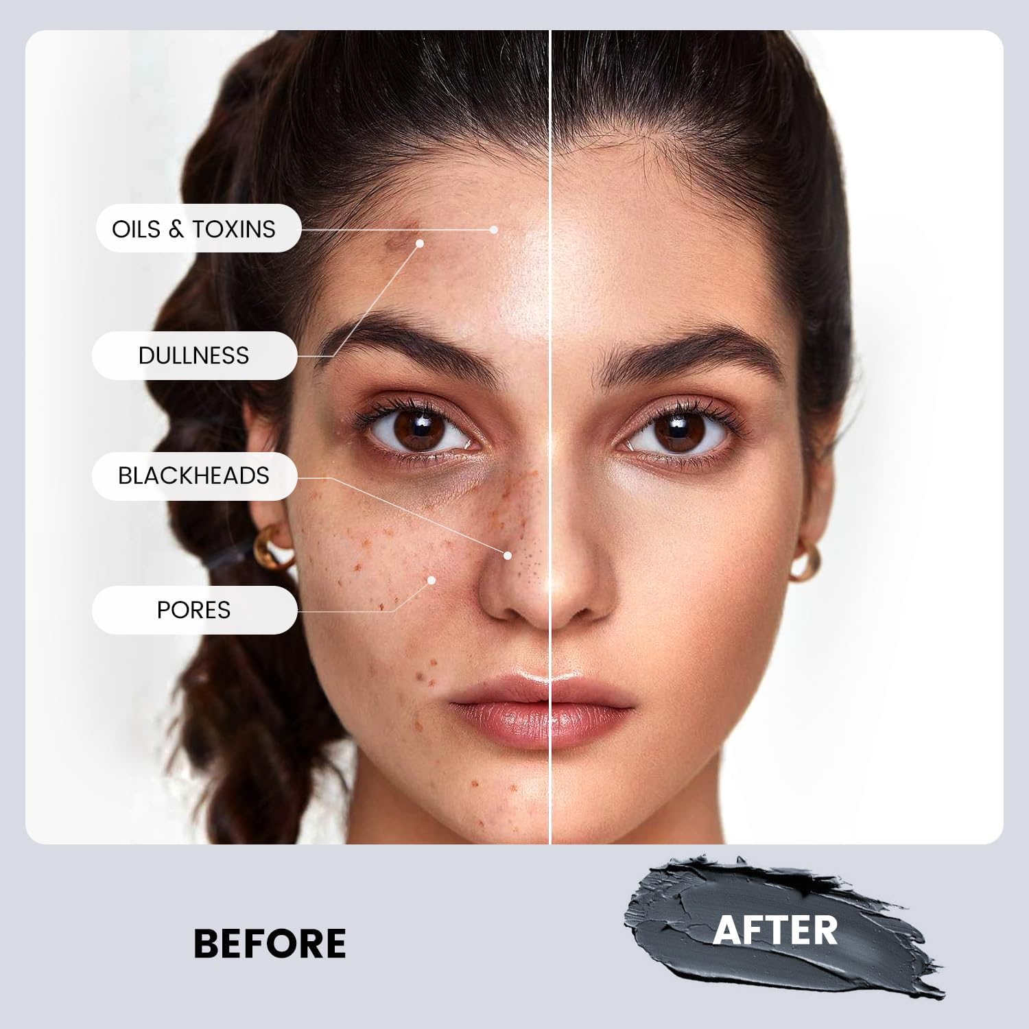 Dead Sea Mud Mask & Rose Clay Facial Mask - Deep Cleansing & Detoxifying for Acne, Blackheads & Oily Skin - Spa Quality Skincare for Glowing Complexion at Home