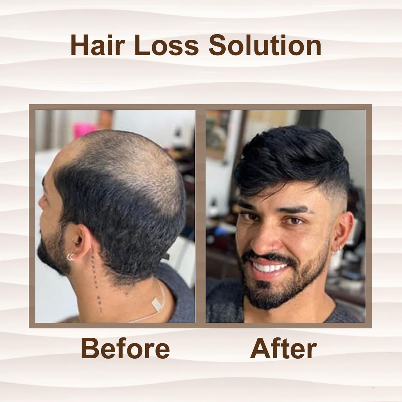 Majik MONOFILAMENT Natural Human Hair Patch Wig for Men - 9x6 Brown with Hair Patch Care Kit (Cleaner & Conditioner) - Works with Glue, Clips or Tape - Perfect for Thinning Hair & Bald Spot Coverage - Daily Wear & Special Occasions