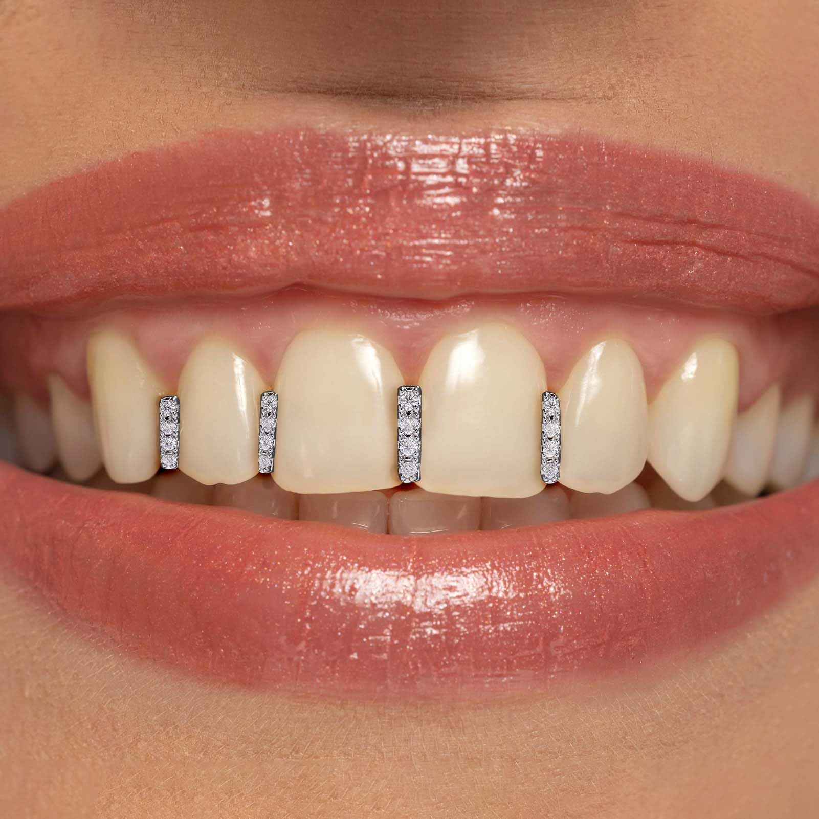 18K Gold/Silver Plated Iced Out Grillz - 2PCS Diamond & CZ Stone Tooth Caps for Men & Women | Hip Hop Rapper Costume Accessory | Perfect for Parties, Concerts & Photo Shoots