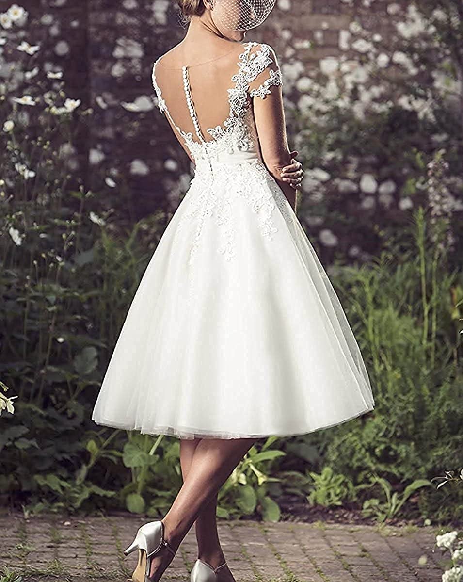 Elegant A-Line Lace Wedding Dresses for Women - Romantic Bridal Gowns with Applique Details | Perfect for Beach, Church & Outdoor Ceremonies