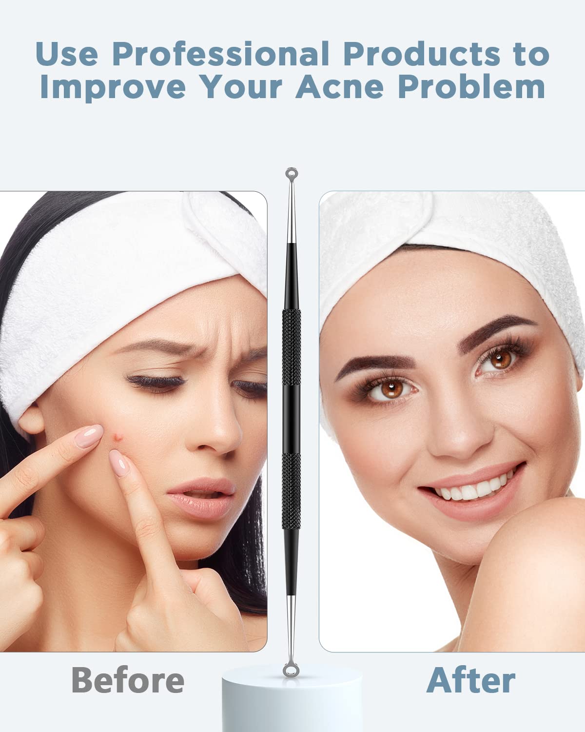 Professional Stainless Steel Blackhead Remover & Pimple Popper Kit - Acne Extractor Tool for Face, Comedones, Whitehead & Blemish Removal - Perfect for Home Skincare & Spa Treatments