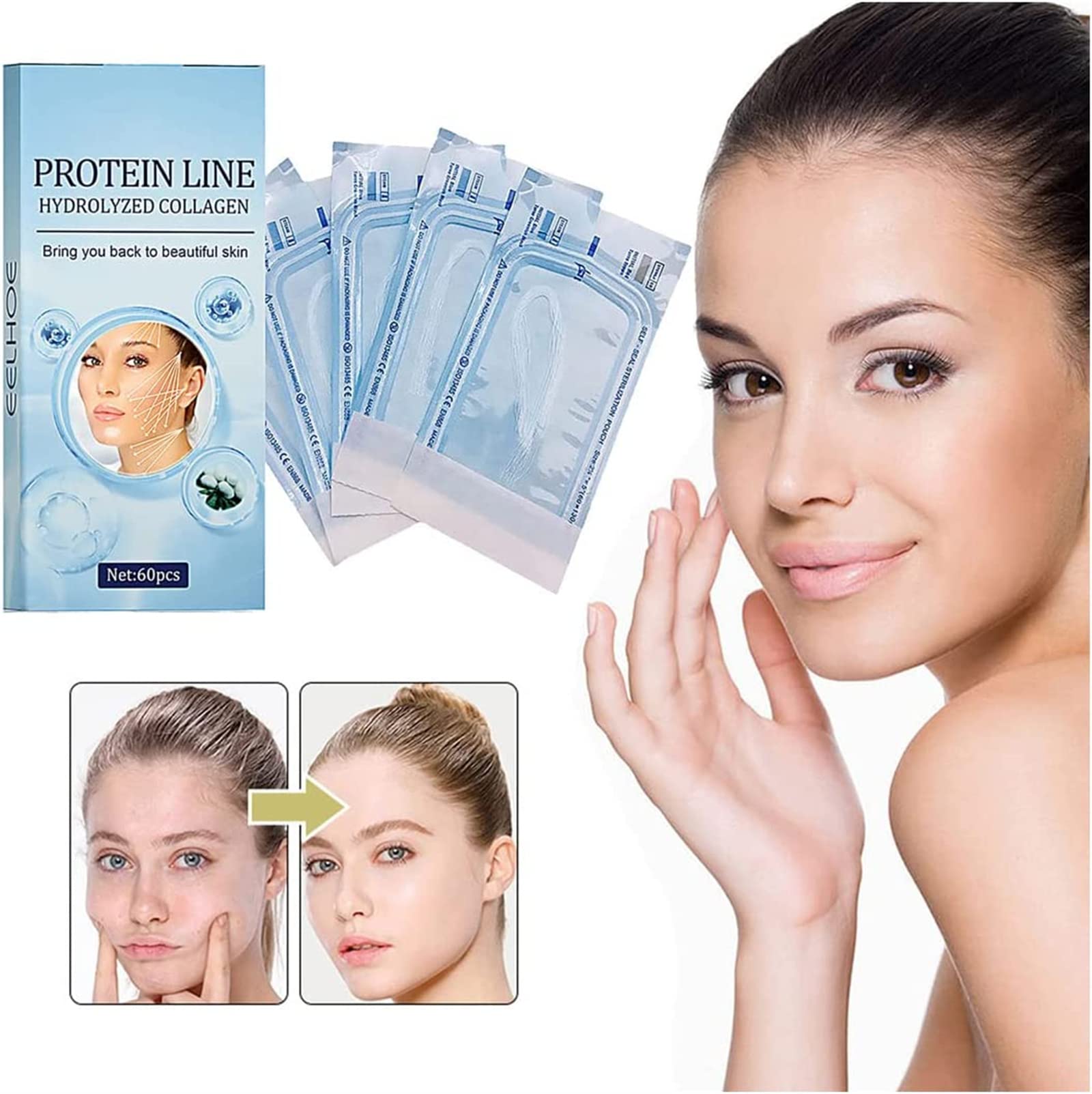 Proform Korean Soluble Protein Threads - 60pcs Face Lift Kit for Instant Lifting