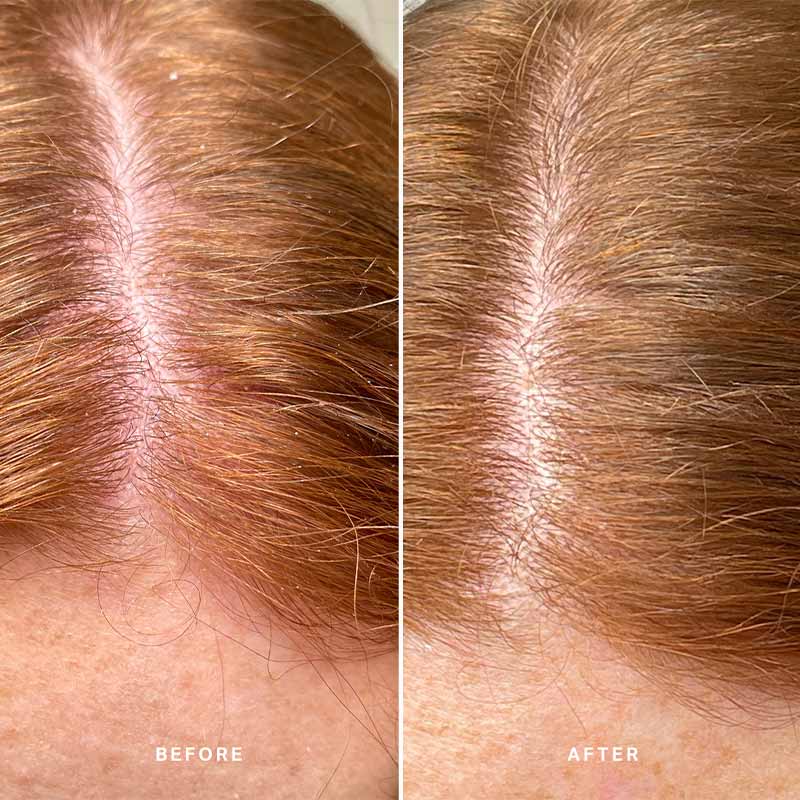Alpha H Healthy Scalp Exfoliating Treatment with Australian Desert Lime - Gentle Scalp Scrub for Dandruff & Dry Scalp Relief - Perfect for Hair Care Routine & Scalp Detox