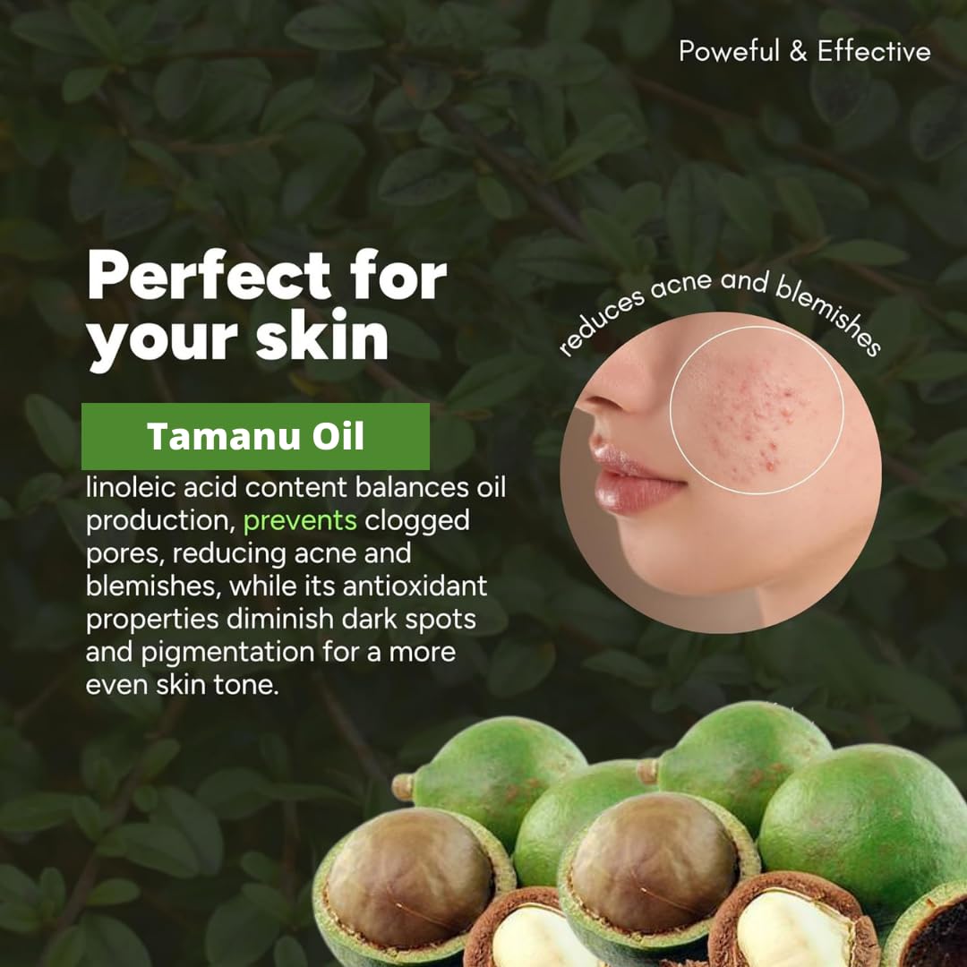 USDA Certified Organic Cold Pressed Tamanu Oil for Psoriasis, Eczema & Acne Scars - Non-GMO, Gluten & Hexane Free Face, Skin & Hair Treatment - Soothes Dry, Scaly & Irritated Skin - 3.4 oz - Perfect for Daily Skincare Routine & Natural Beauty Regimen
