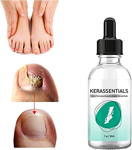 Kerassentials Toenail Fungus Treatment Oil - Fast-Acting Antifungal Nail Solution for Toenail & Fingernail Fungus - 1 Bottle (Perfect for Athletes, Swimmers & Pedicure Lovers)