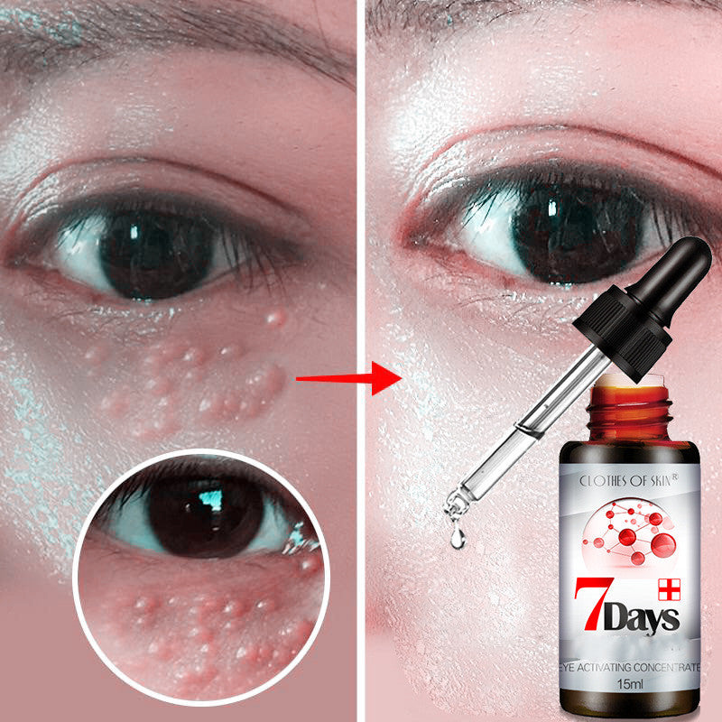 Dark Circle Reducing Eye Serum - Skin Rejuvenating Treatment for Brighter Under Eyes | Perfect for Nighttime Skincare & Anti-Aging Routine