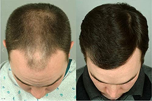 Premium Confidence Synthetic Hair Wig for Men & Boys - Dark Brown | Natural Look & Comfortable Fit for Daily Wear, Cosplay & Costume Parties
