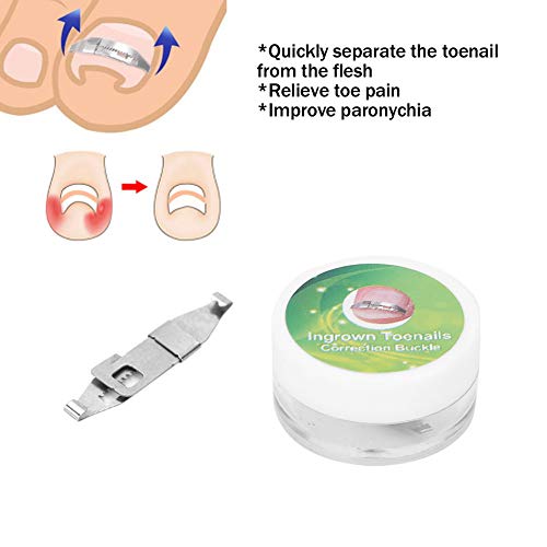 Yosoo Health Gear Stainless Steel Ingrown Toenail Corrector - Paronychia Treatment Tool & Nail Care Patch for Pain Relief | Perfect for Home Pedicure, Toenail Correction & Foot Care Routine