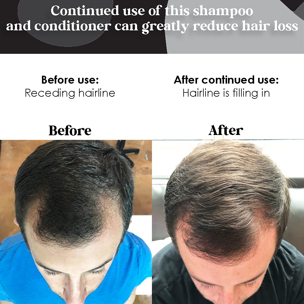 Biotin Shampoo and Conditioner Set for Hair Growth - Vitamin E, A, C & B Enriched Formula to Strengthen & Thicken Hair - Sulfate Free & Paraben Free (8.5oz) - Perfect for Thinning Hair, Damaged Hair & Daily Hair Care Routine