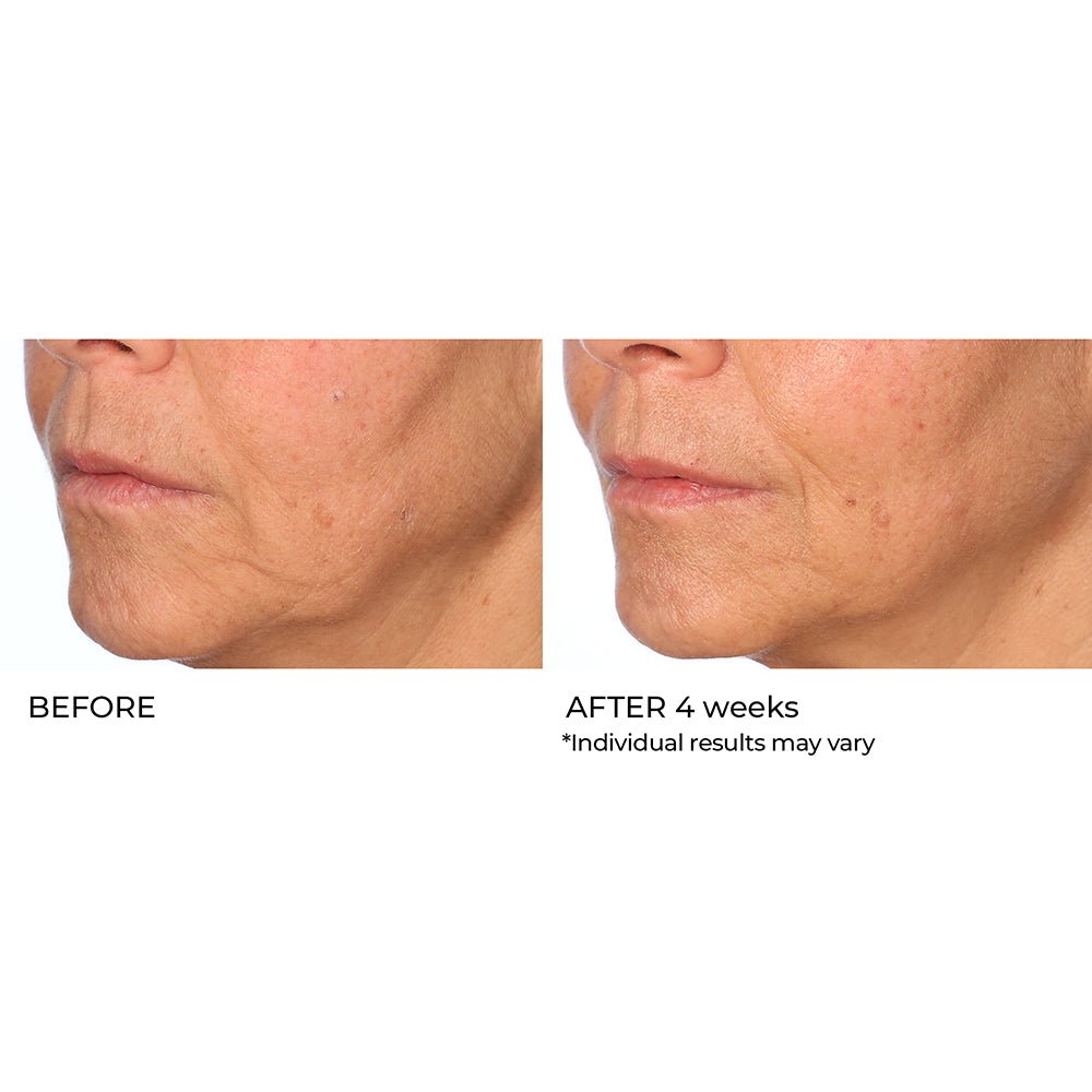 Best Vitamin C Serum for Brightening Skin - Radiance Brightening Booster | Anti-Aging & Dark Spot Treatment for Face | Perfect for Morning Skincare Routine & Glowing Complexion