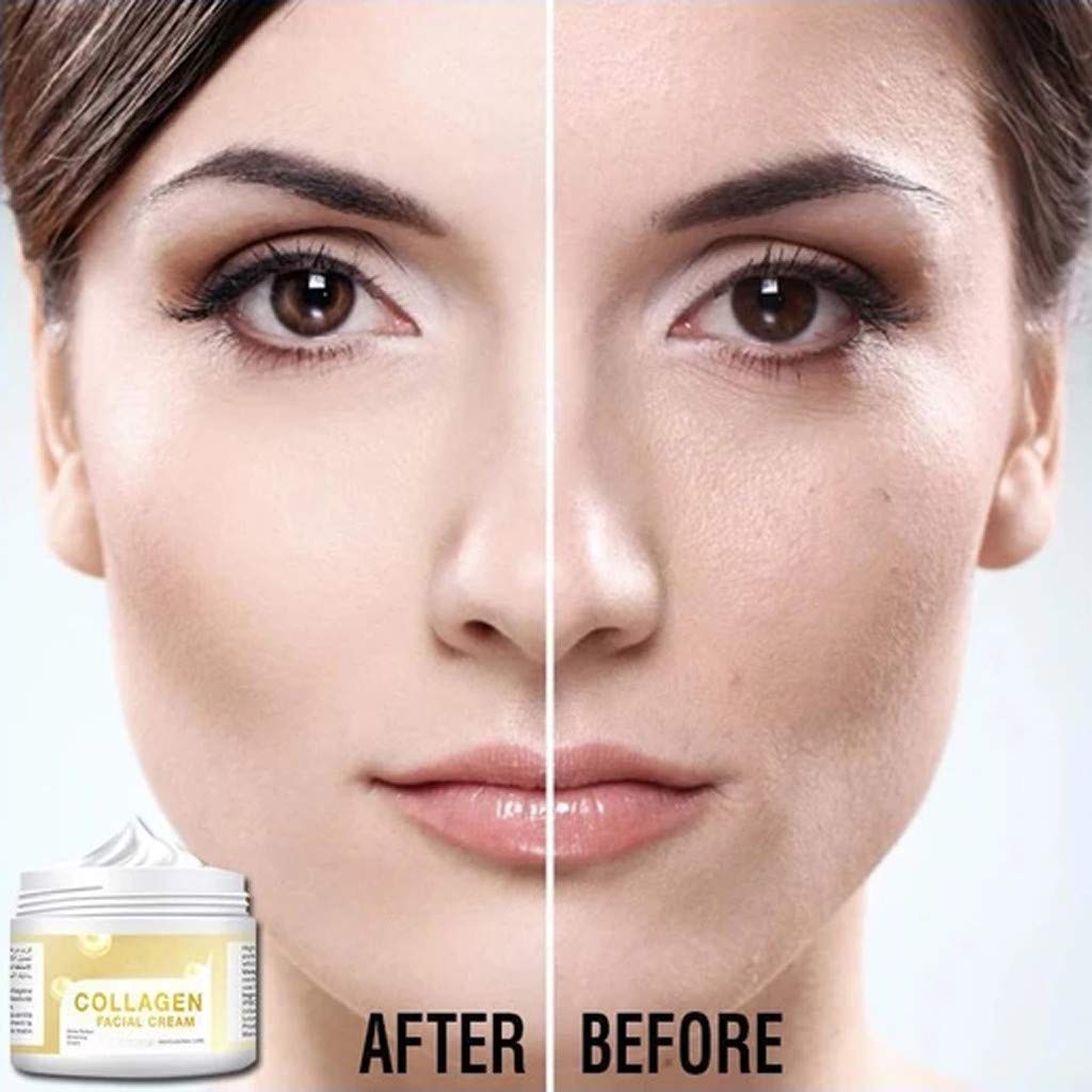 Yue668 30g Hyaluronic Acid Collagen Face Cream - Anti-Wrinkle, Anti-Aging & Whitening Moisturizer for Day Use | Deep Hydration & Nourishing Skin Care (White) | Perfect for Dry Skin & Daily Anti-Aging Routine
