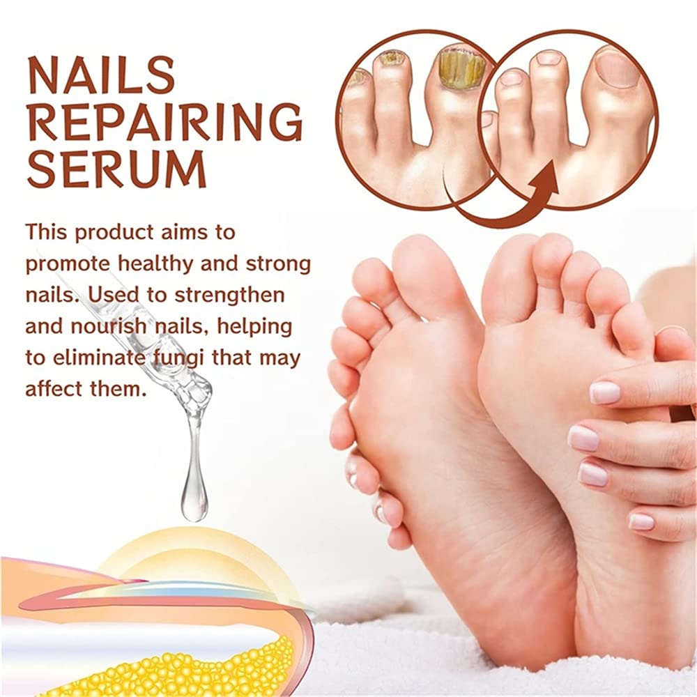 Pisheng 7-Day Nail Growth & Strengthening Serum - 20ml (2-Pack) | Fast Nail Treatment for Stronger, Healthier Nails | Perfect for Brittle Nails & Nail Care Routine