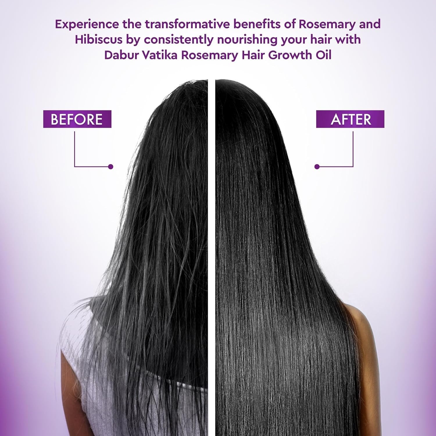 Dabur Vatika Rosemary Hair Growth Oil with Hibiscus & Coconut Oil - 200ml | Stimulates Hair Growth, Thickens Hair | Dermatologist Recommended | No Mineral Oil, Cruelty-Free | For Dry, Damaged Hair & Scalp Care | Perfect for Daily Hair Massage & Nourishment