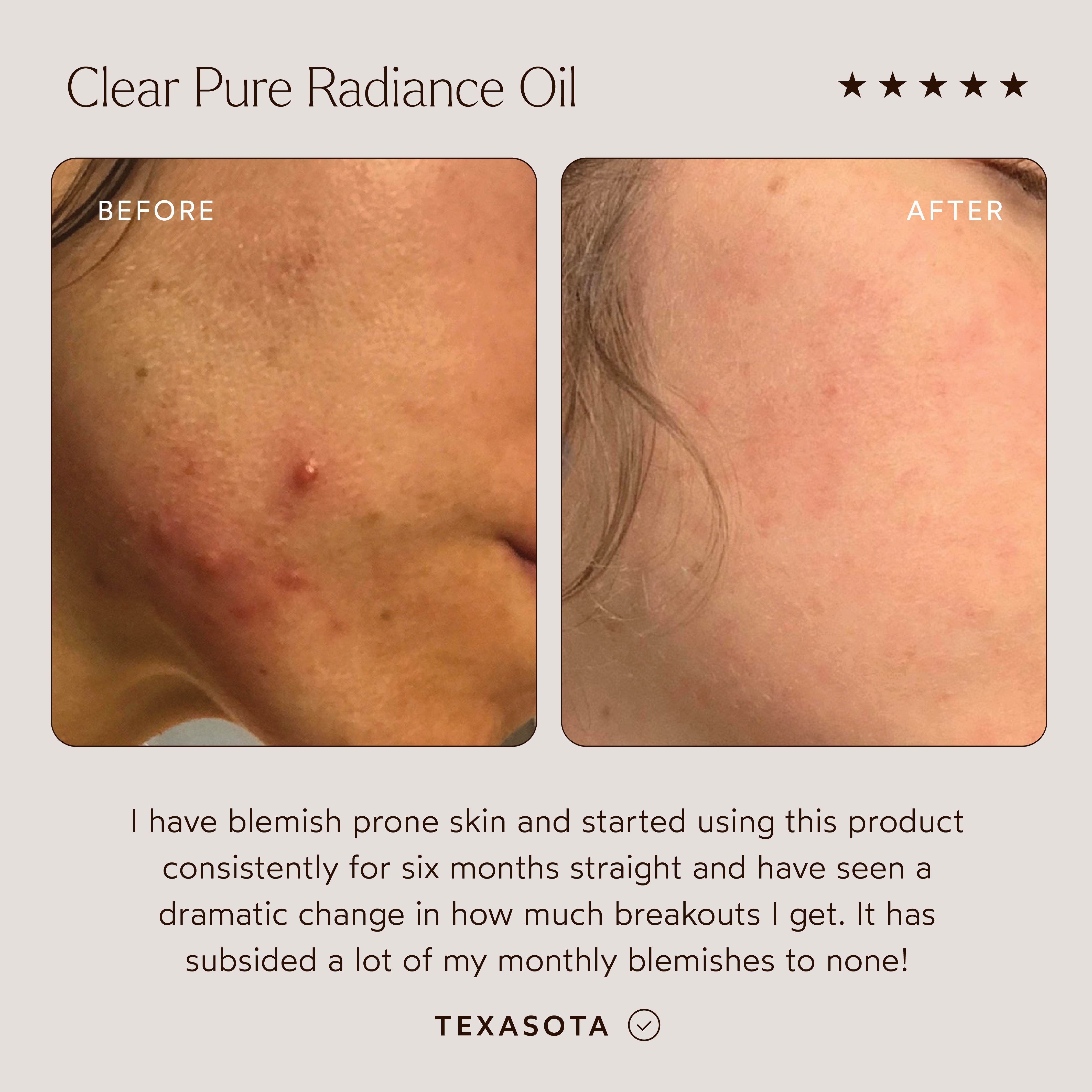Pure Radiance Facial Oil for Glowing Skin - Hydrating & Brightening Face Oil for Dry & Dull Skin | Day & Night Skincare Routine