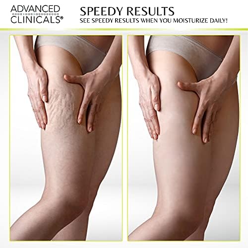Advanced Clinicals Green Coffee Bean Oil Firming Cream & Vitamin C Body Oil Set - Anti-Cellulite Treatment for Smooth, Tight Skin | Perfect for Post-Workout Recovery & Nighttime Skincare Routine