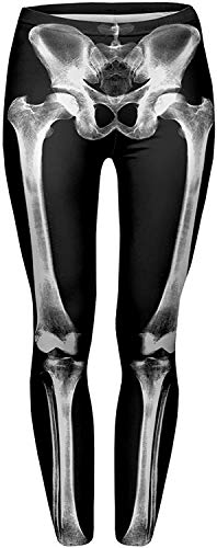 Bones