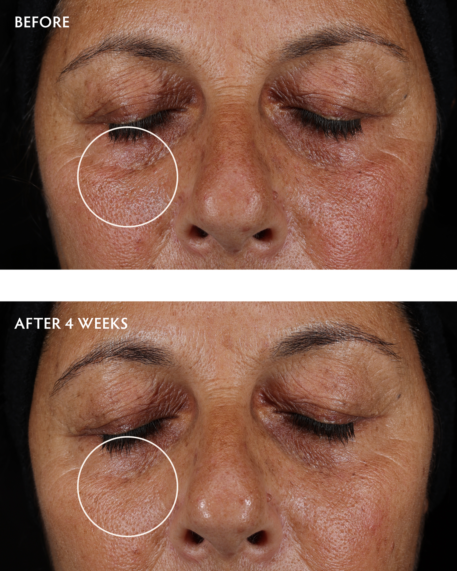Best Caffeine + Peptide Eye Serum for Dark Circles & Puffiness - Anti-Aging Under Eye Treatment for Brighter, Youthful Look - Perfect for Morning Skincare Routine & Travel