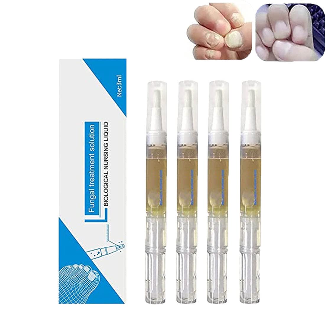 Okita Toenail Fungus Treatment Pen - Anti Fungal Nail Repair for Broken & Discolored Nails - Restores Healthy Strong Nails (4 Pack) - Perfect for Athletes, Pedicures & Daily Foot Care