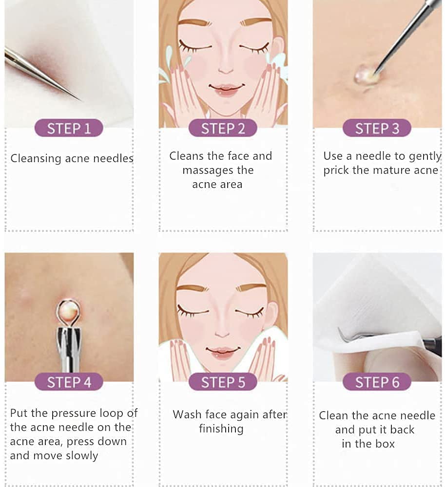 Professional Blackhead Remover Kit - Stainless Steel Pimple & Blemish Extractor with Anti-Slip Handle, 4-Piece Set with Storage Case - Perfect for Facial Skincare and Acne Treatment at Home