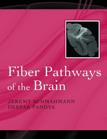 Fiber Pathways of the Brain - Neuroscience Research & Human Brain Anatomy Study - Perfect for Neurology Students, Researchers & Medical Professionals