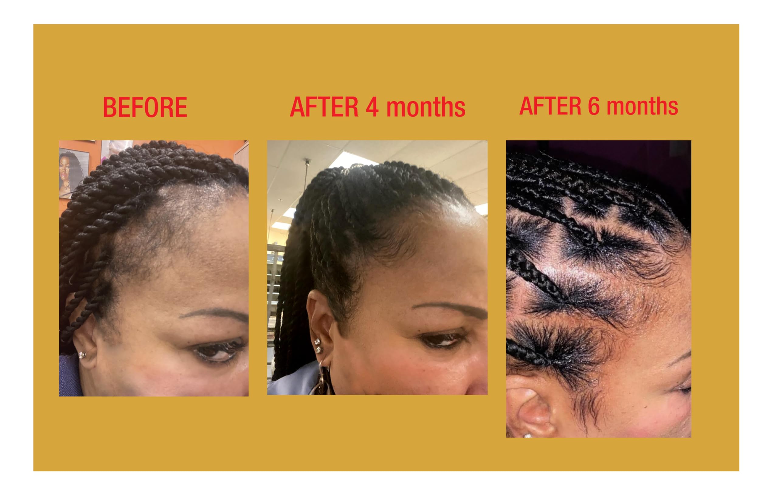 GOOD2GRO Hydrating & Strengthening Hair Care Set - 100% Vegan & Cruelty Free Formula for Dry & Damaged Hair - Perfect for Daily Hydration & Hair Repair at Home