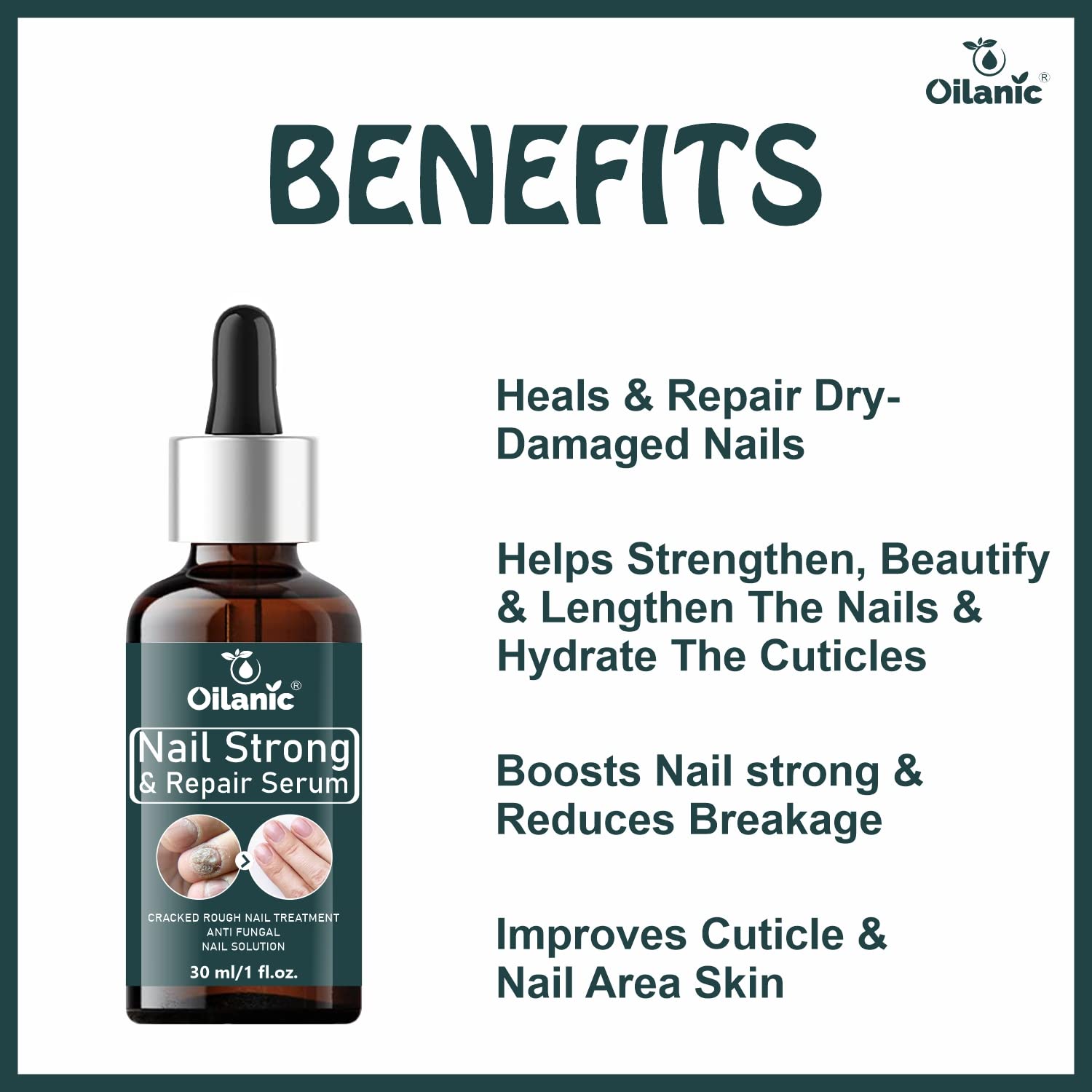 Oilanic Nail Growth Serum - Strengthen & Shine Nails | Cuticle Care Treatment | 2 Pack (60ml Total) | Perfect for Weak, Brittle Nails & Professional Manicures
