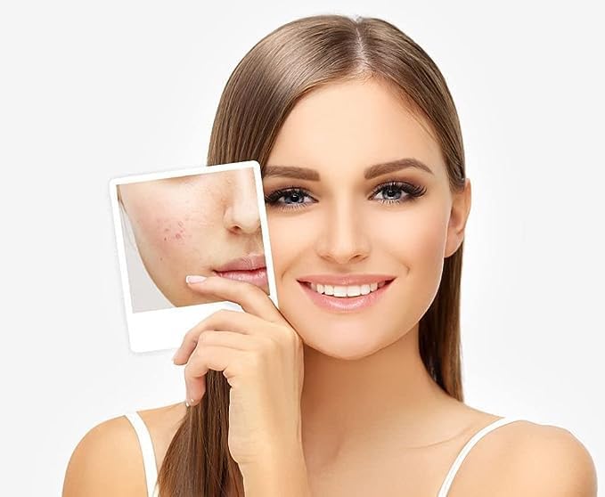 Organic Neem Powder for Acne & Dark Circles - 100% Pure Herbal Anti-Bacterial Leaf Powder for Men & Women - Promotes Thicker, Stronger Skin - Natural Health Supplement (100g) | Ideal for DIY Face Masks, Skincare Routines & Herbal Remedies