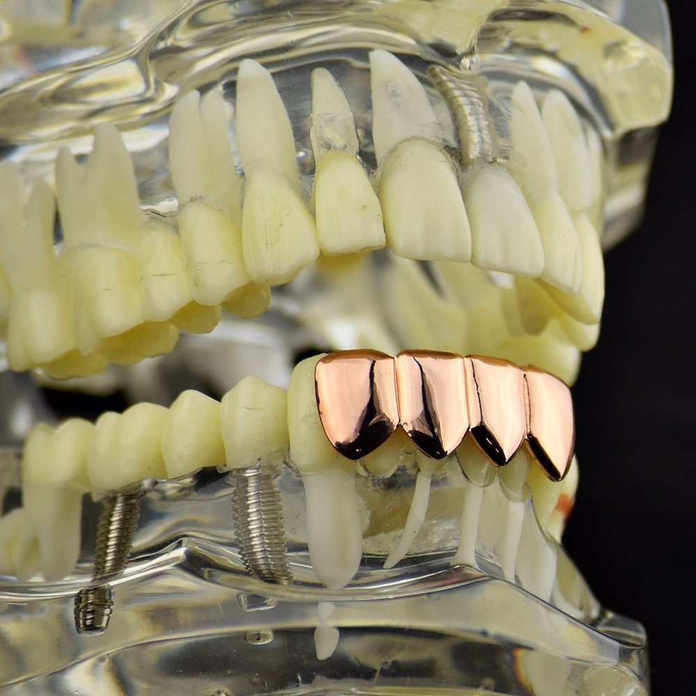 14K Rose Gold Plated Hip Hop Grillz - 4 Tooth Lower Quad Teeth Grills for Men & Women - Perfect for Rap Performances, Music Videos, and Streetwear Fashion