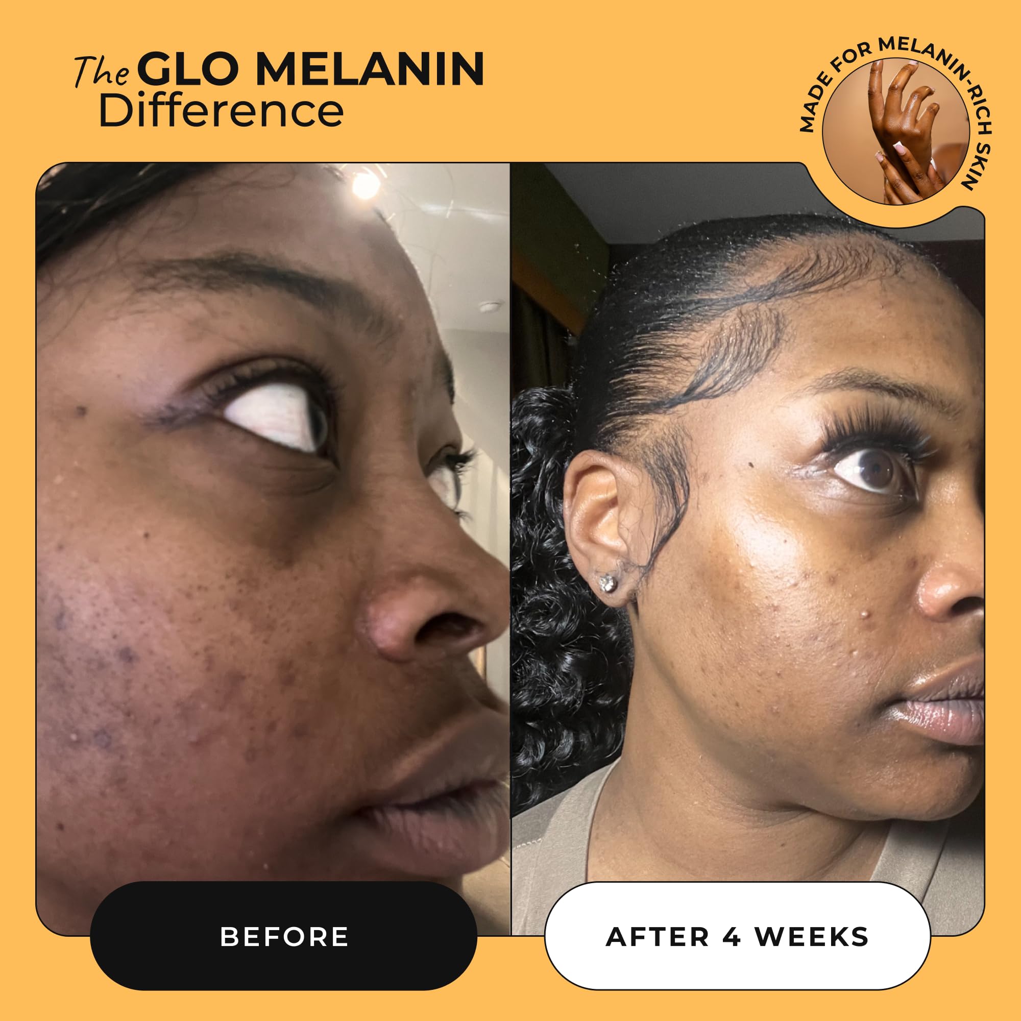 Glo Melanin Raw Manuka Honey & Turmeric Face Wash - Exfoliating Cleanser for Glowing Skin - Natural Facial Wash for Women - 4 Oz - Perfect for Daily Skincare Routine & Acne-Prone Skin