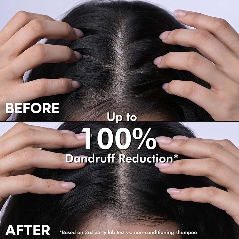 Natural Tea Tree Oil & Cactus Extract Anti-Dandruff Shampoo - Sulfate & Paraben Free, Scalp Soothing Treatment for Dry, Itchy Scalp - 200ml Bottle for Men & Women - Perfect for Daily Hair Care & Dandruff Prevention