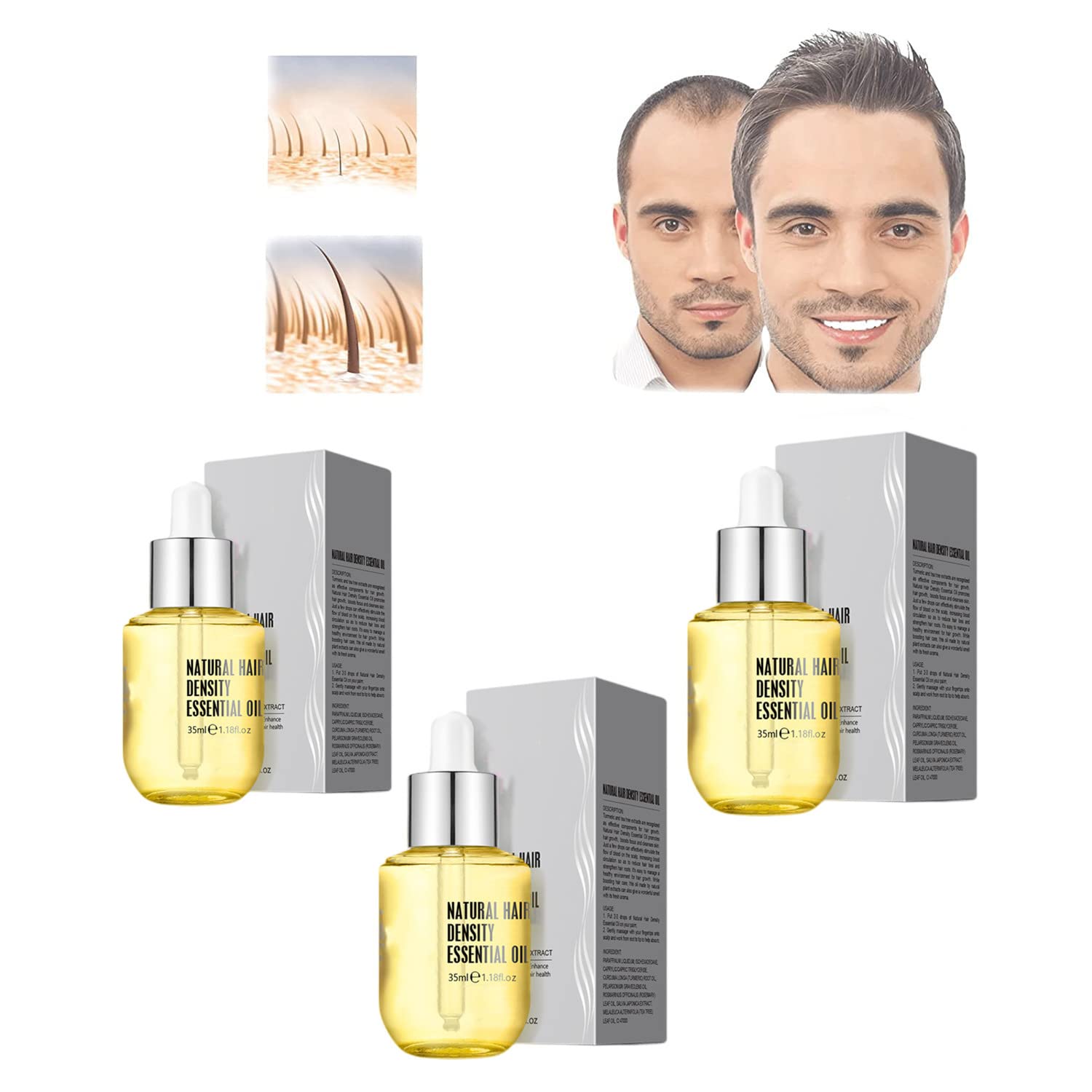 Natural Ginger Hair Growth Serum for Thinning Hair - Essential Oil Treatment for Men & Women | Promotes Hair Density & Scalp Health | Perfect for Daily Hair Care Routine & Styling Prep