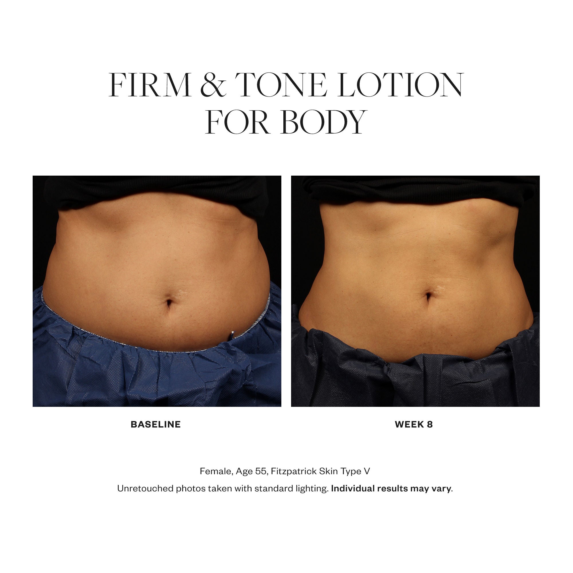 Firm & Tone Body Lotion for Smooth Skin - Anti-Cellulite & Moisturizing Treatment for Women - Perfect for Daily Use & Post-Workout Recovery