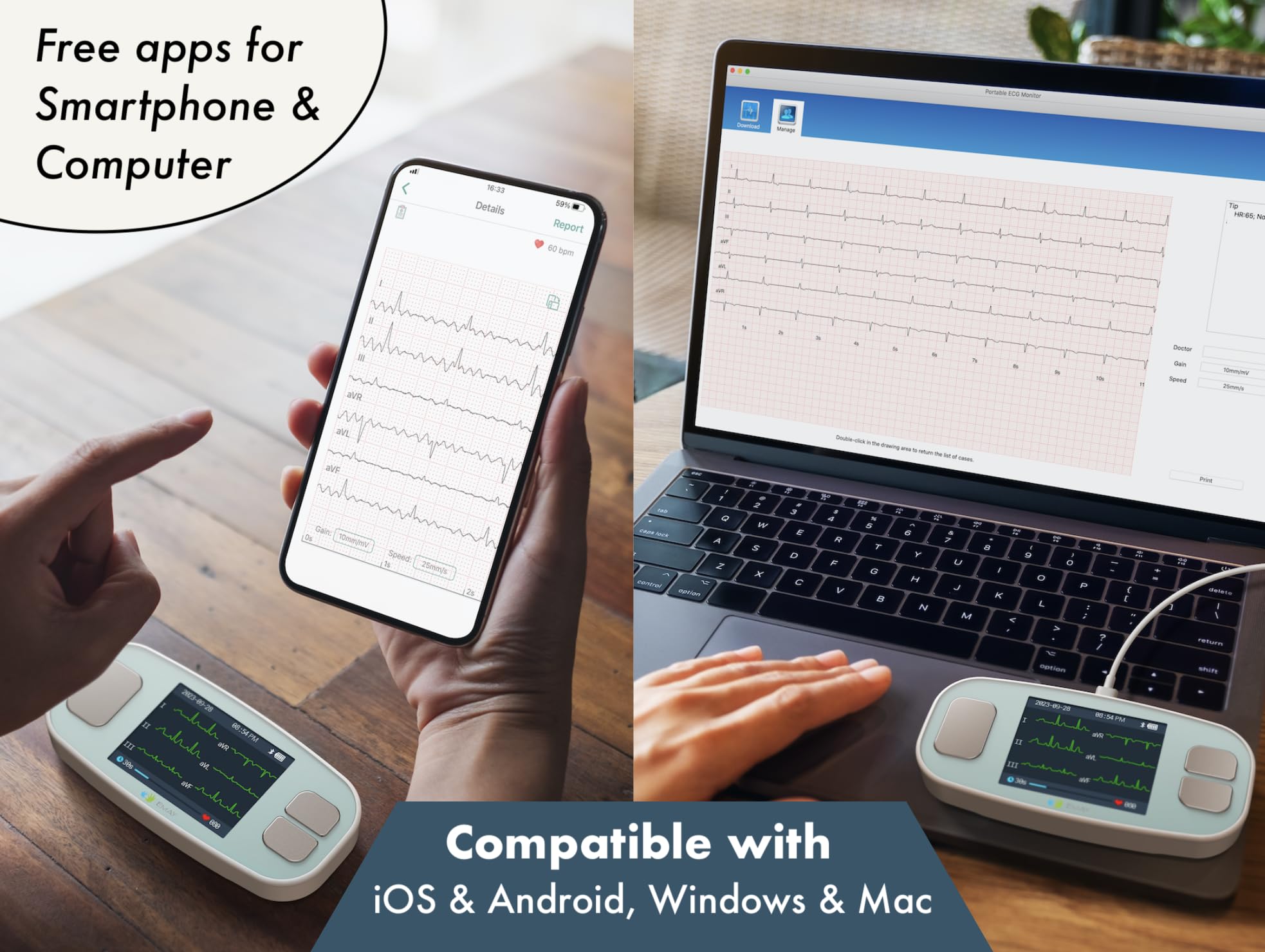 EMAY 6L Portable ECG Monitor - 6 Channel Heart Rate Monitor with Smartphone & PC Compatibility | No Subscription Required | Home Health Monitoring for Heart Patients & Fitness Enthusiasts