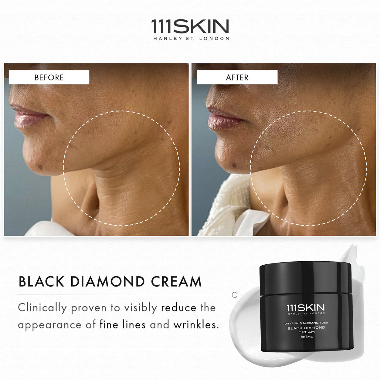 Black Diamond Anti-Aging Cream - Premium Skin Brightening & Wrinkle Reduction Treatment for Face & Neck - Perfect for Nighttime Skincare Routine & Daily Moisturizing