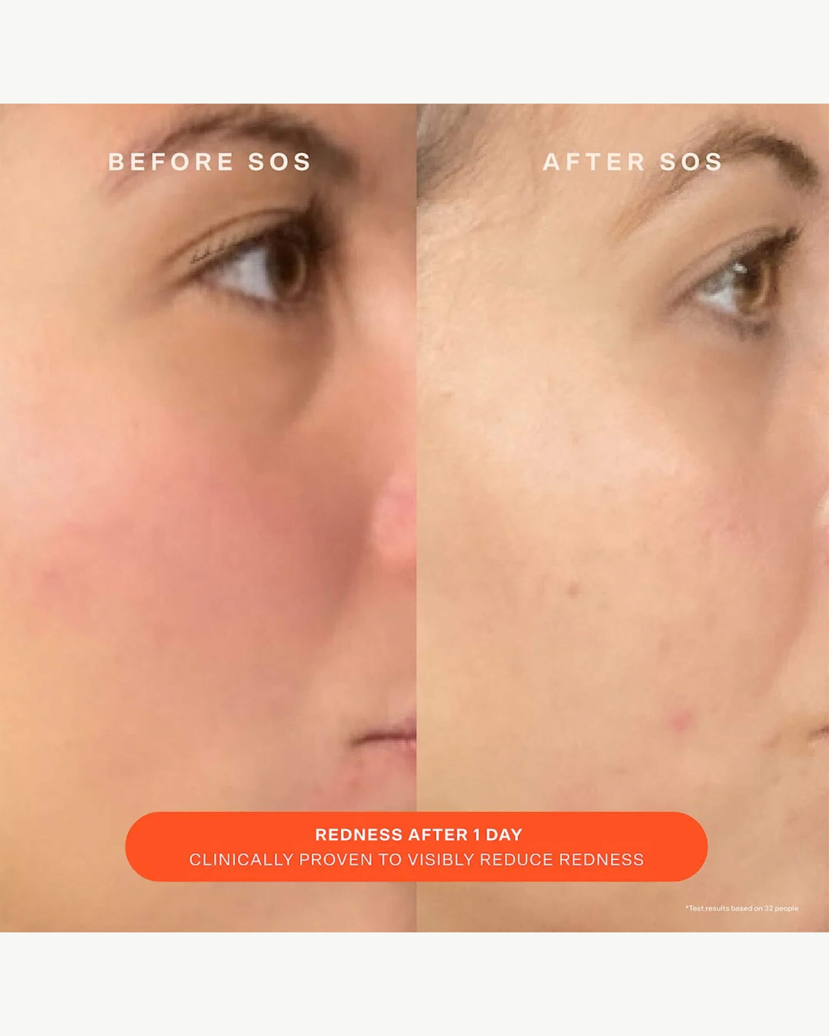SOS Daily Barrier Recovery Cream for Dry, Sensitive Skin - Hydrating Moisturizer with Ceramides & Hyaluronic Acid - Perfect for Nighttime Skincare Routine & Post-Procedure Care