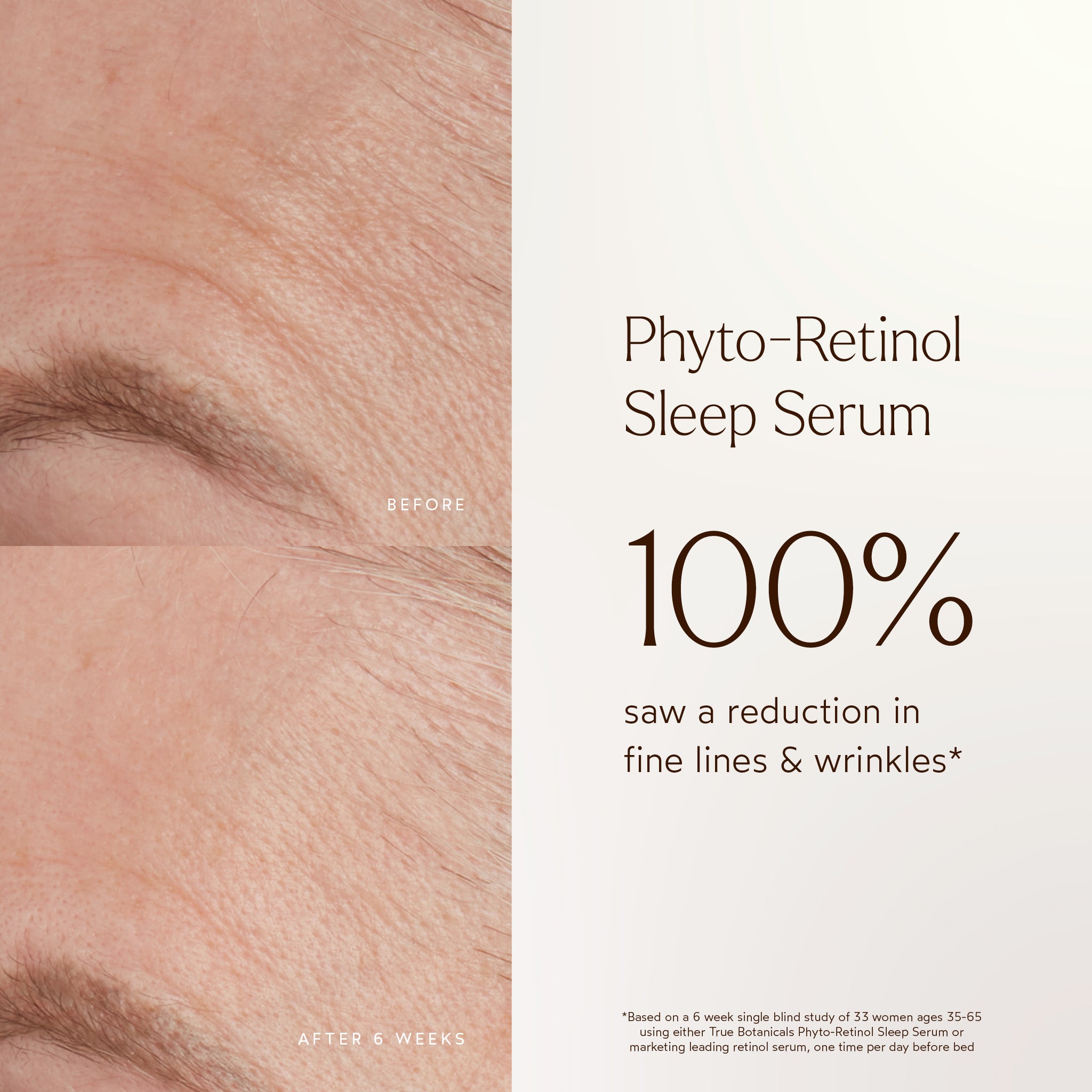 Best Phyto Retinol Anti-Aging Sleep Serum for Wrinkles & Fine Lines - Overnight Skin Repair Treatment for Youthful Glow | Perfect for Nighttime Skincare Routine