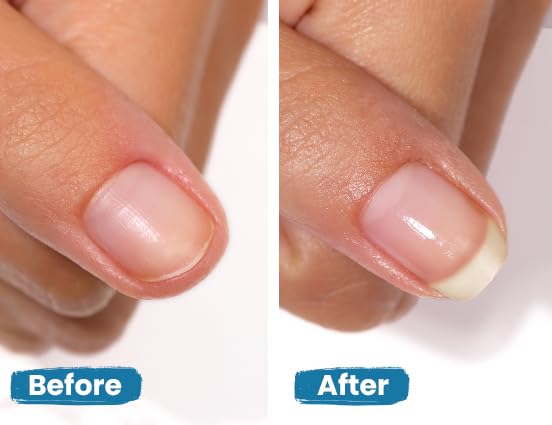 LONDONTOWN Get Strong Nail Hardener & Strengthener - Nail Growth Treatment for Damaged, Weak Nails | Conditioning Care for Long Healthy Nails | .40 fl oz | Perfect for Brittle Nails & Nail Recovery After Gel/ Acrylic Extensions