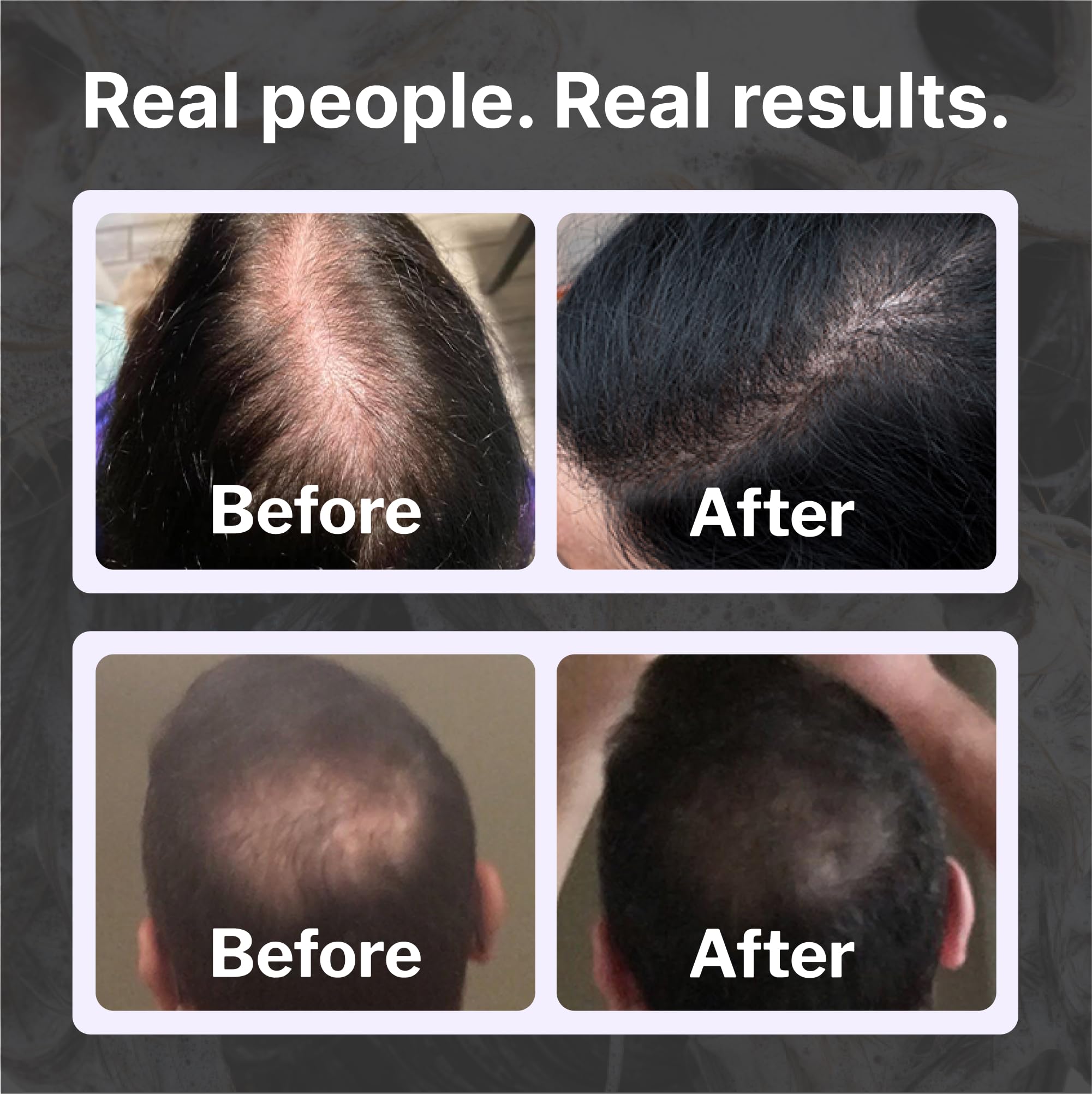 Shapiro MD Hair Growth Kit - Natural Shampoo, Conditioner & Leave-In Foam for Thicker, Fuller & Healthier Hair (2 Month Supply) - Best for Thinning Hair, Hair Loss Treatment & Scalp Care - Perfect for Men & Women at Home or Salon Use